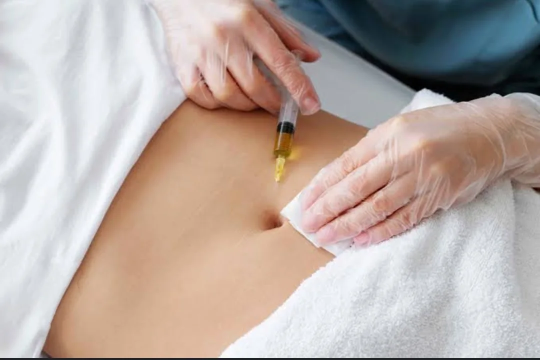 Lipolytic treatment consultation
